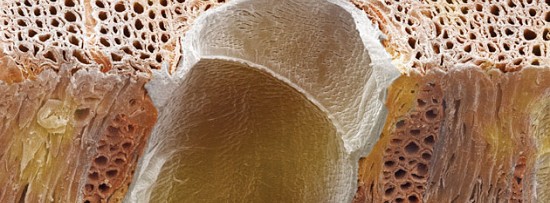 A biomass bonanza